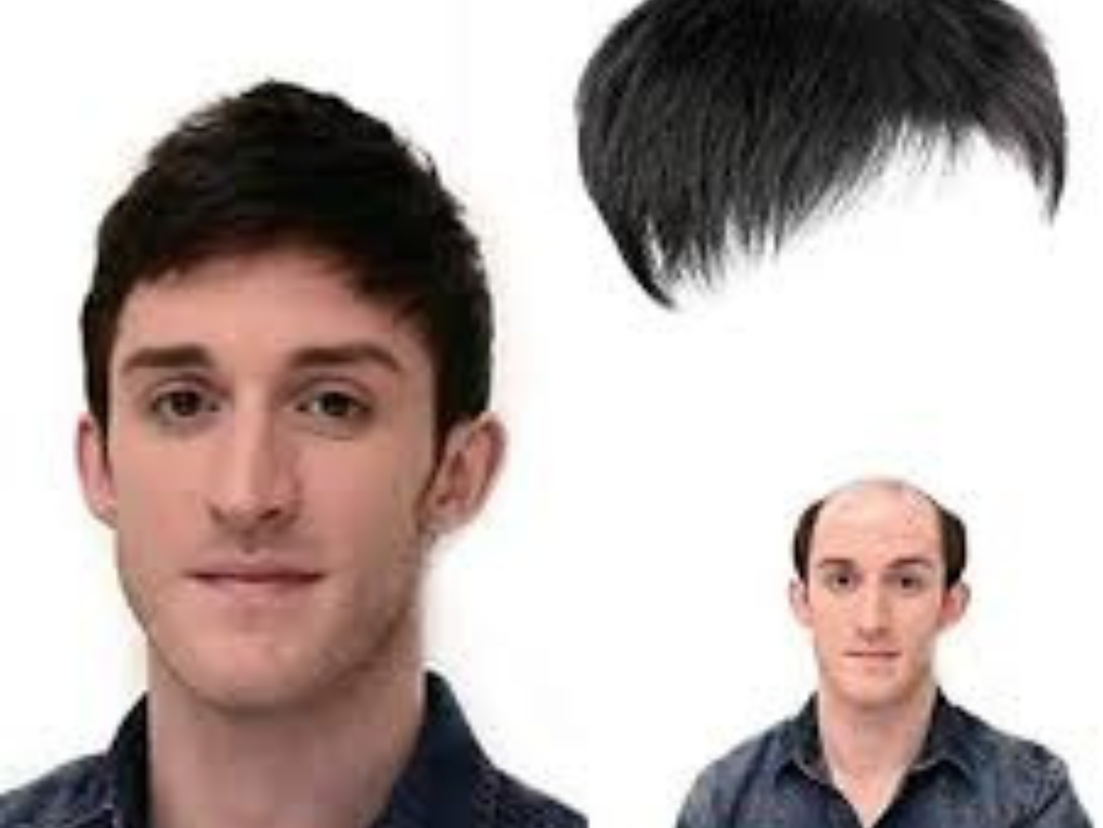 hair patch in hyderabad