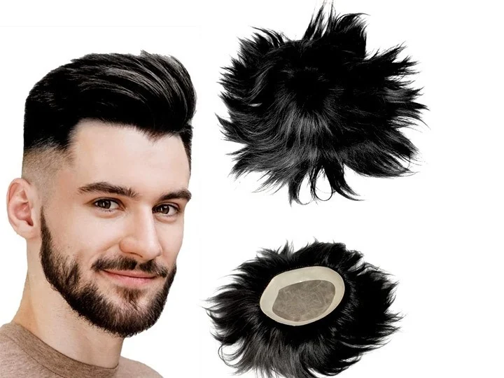 hair patch in hyderabad