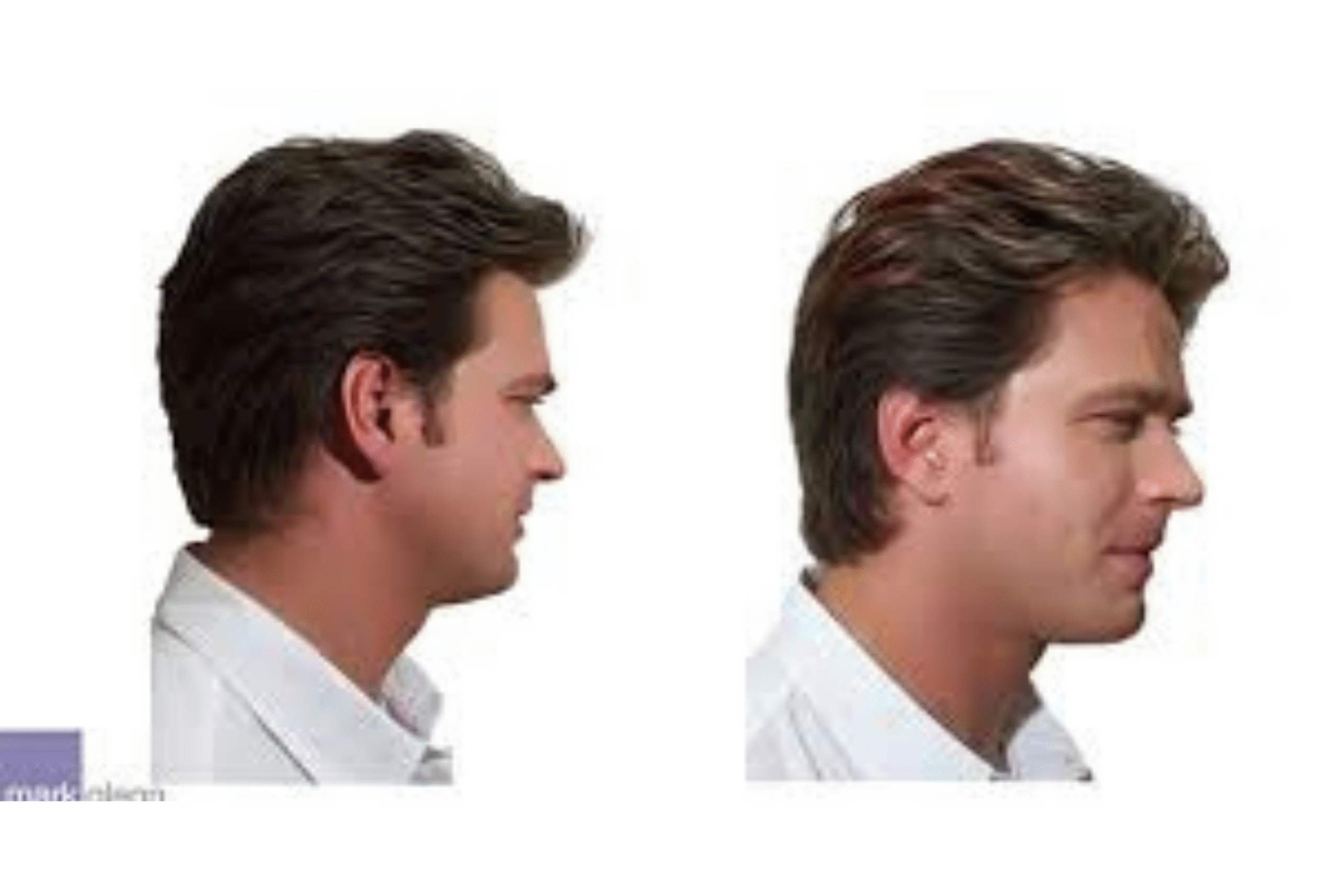 Best Permanent Hair Extensions In Madhapur