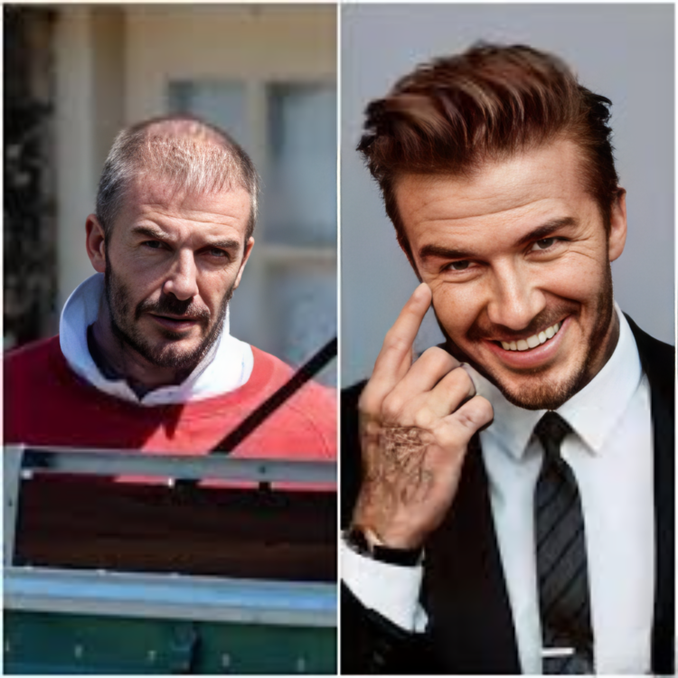 Before and after male hair restoration showing balding scalp and full styled hair transformation