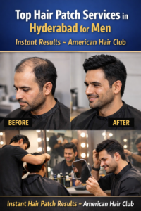 American Hair Club hair patch services in Hyderabad showing instant results for men