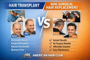Hair transplant vs non surgical hair replacement comparison treatment at American Hair Club