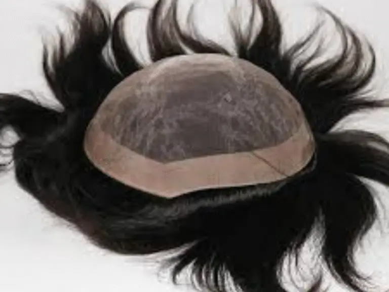 hair patch in hyderabad