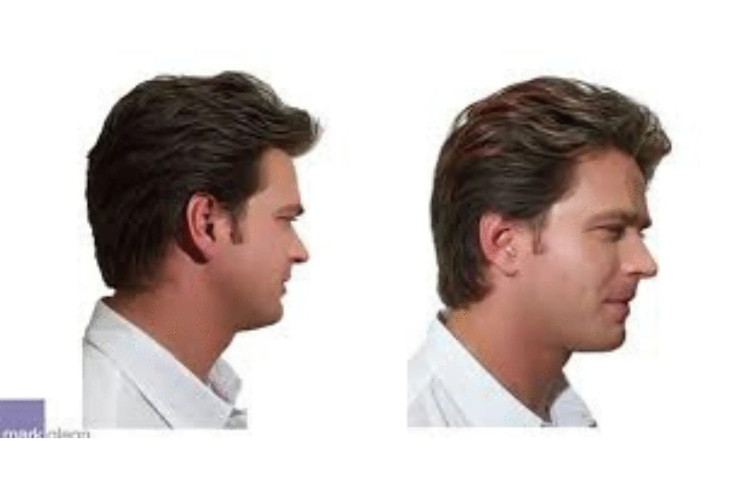 Best Permanent Hair Extensions In Madhapur