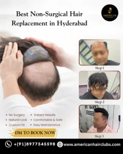 Best Non-Surgical Hair Replacement in Hyderabad using natural hair patch system