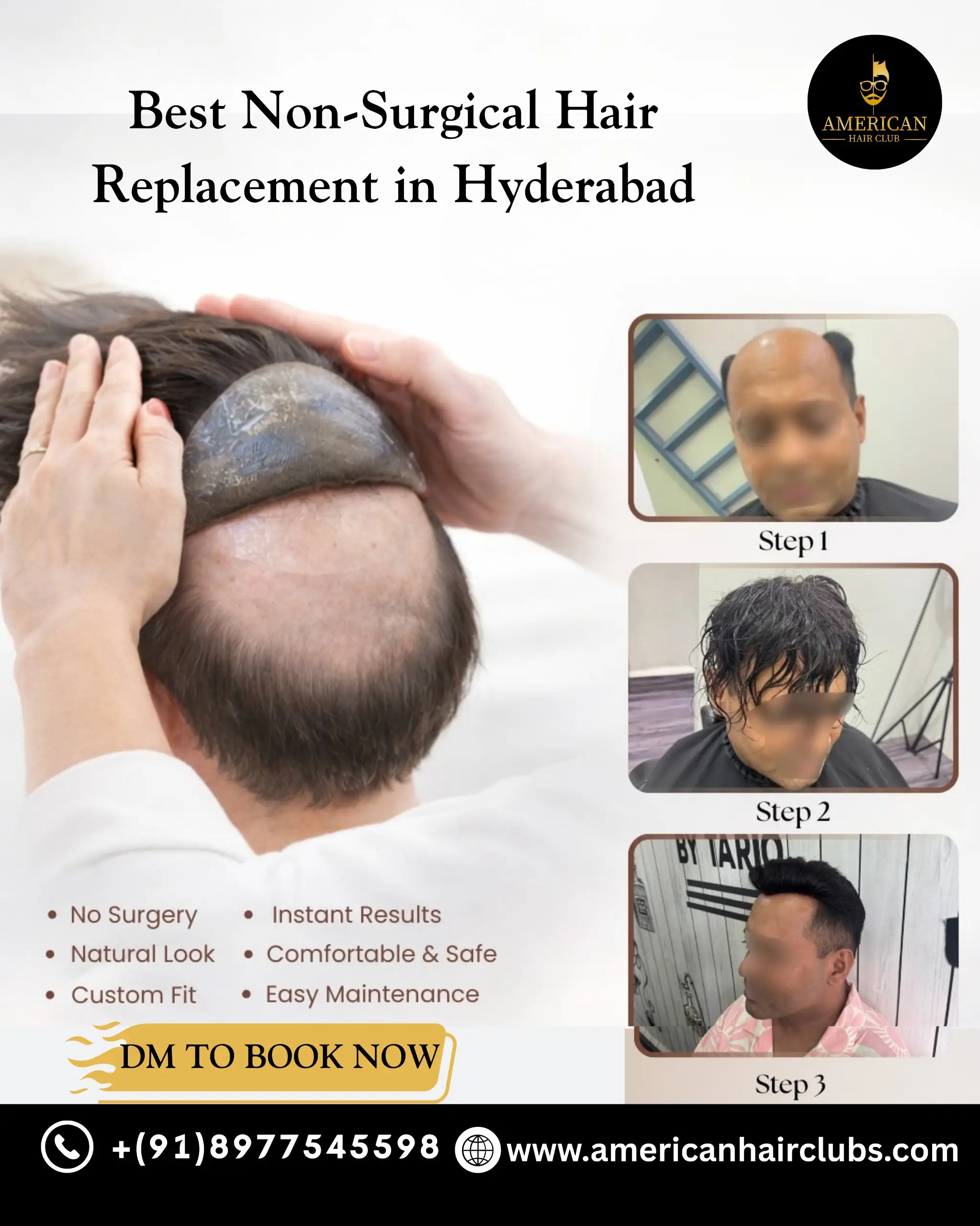 Best Non-Surgical Hair Replacement in Hyderabad using natural hair patch system