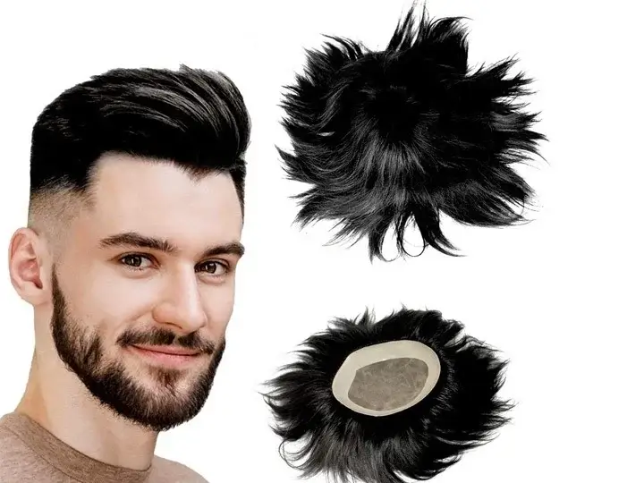 hair patch in hyderabad